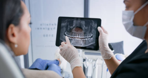 Licensed Teeth Whitening service in St. Louis city County, MO - Smile Center Dentistry